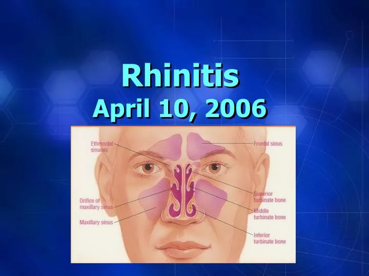 rhinitis april 10 2006