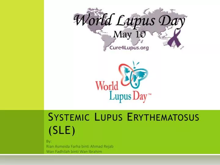 systemic lupus erythematosus sle