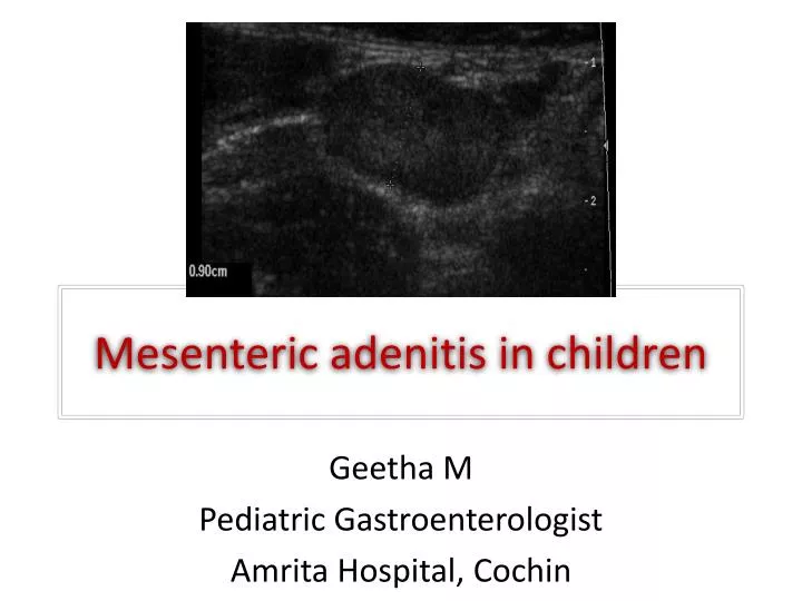 mesenteric adenitis in children