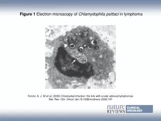 Figure 1 Electron microscopy of Chlamydophila psittaci in lymphoma