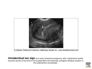 1trimester