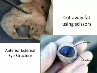 Cut away fat using scissors