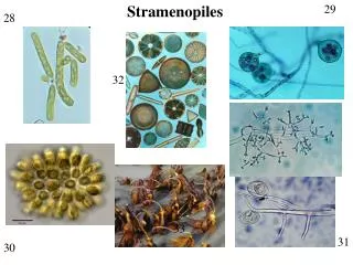 Stramenopiles