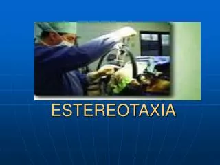 estereotaxia