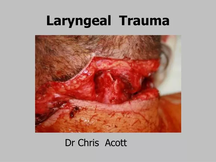 laryngeal trauma