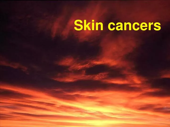 skin cancers