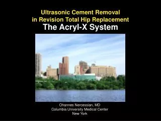 Ultrasonic Cement Removal in Revision Total Hip Replacement The Acryl-X System
