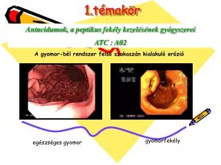 1 t mak r
