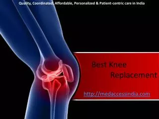 Best knee replacement