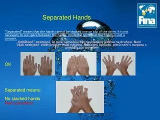 separated hands
