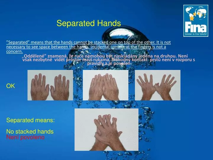 separated hands