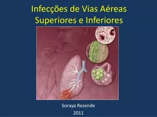 infec es de vias a reas superiores e inferiores