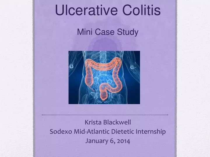 ulcerative colitis mini case study