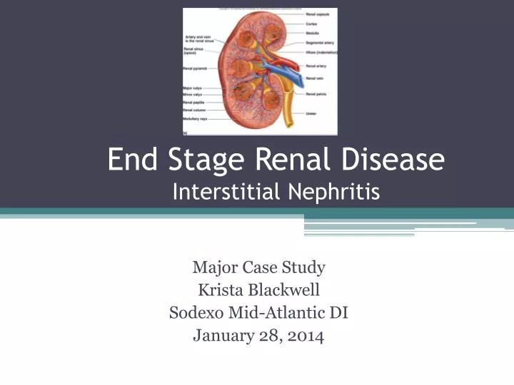 end stage renal disease interstitial nephritis