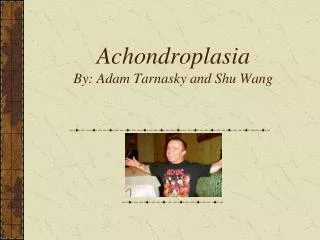 Achondroplasia By: Adam Tarnasky and Shu Wang