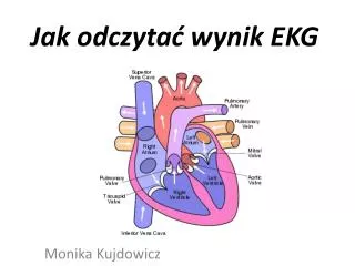 jak odczyta wynik ekg