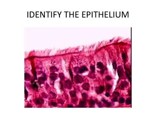 IDENTIFY THE EPITHELIUM
