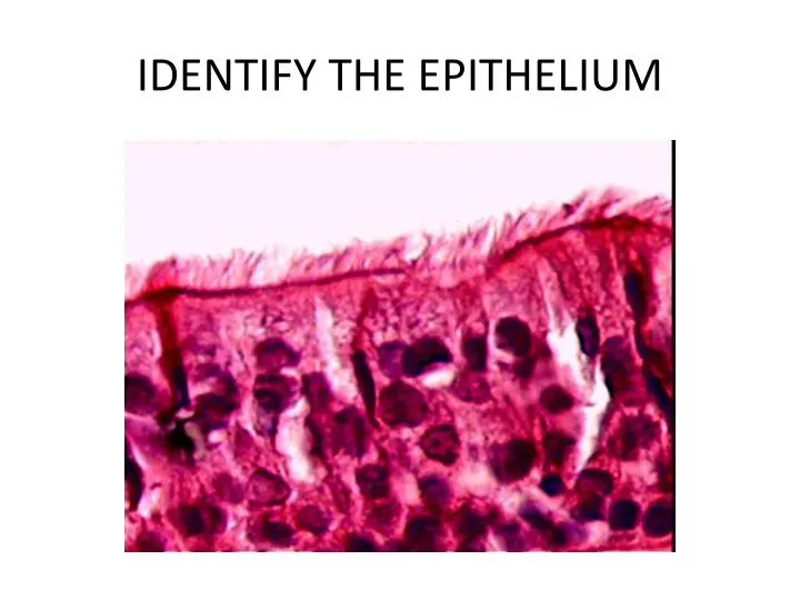 identify the epithelium