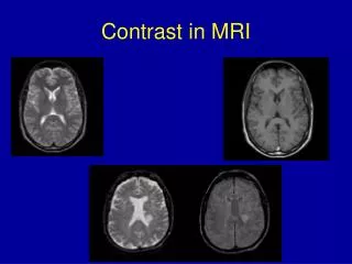 Contrast in MRI