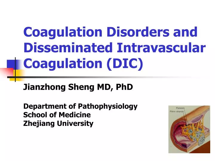 coagulation disorders and disseminated intravascular coagulation dic