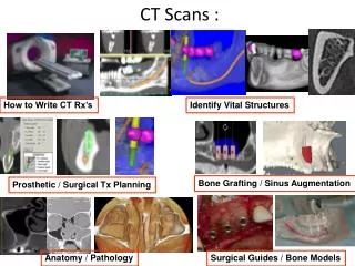 CT Scans :