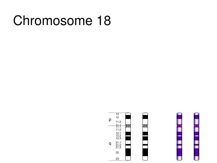 chromosome 18