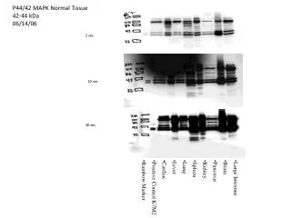 P44/42 MAPK Normal Tissue 42-44 kDa 06/14/06