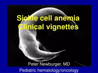 Sickle cell anemia Clinical vignettes