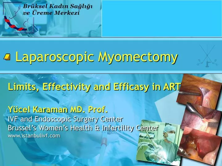 laparoscopic myomectomy