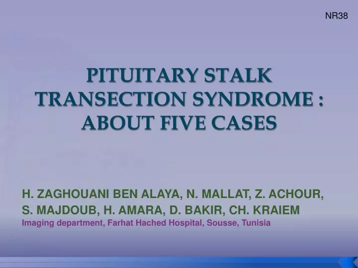 pituitary stalk transection syndrome about five cases
