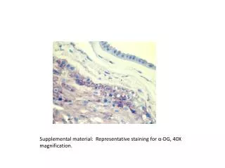 Supplemental material: Representative staining for ?-DG, 40X magnification.