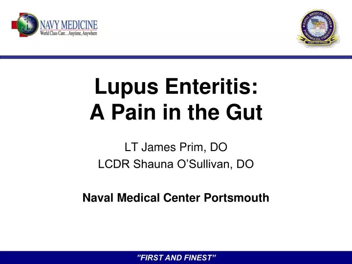 lupus enteritis a pain in the gut