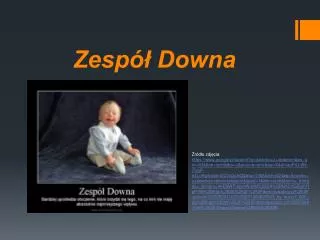 zesp downa