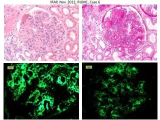 irap nov 2012 rumc case 6