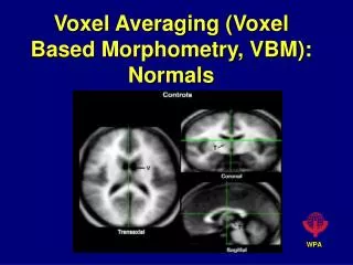 Voxel Averaging (Voxel Based Morphometry, VBM): Normals