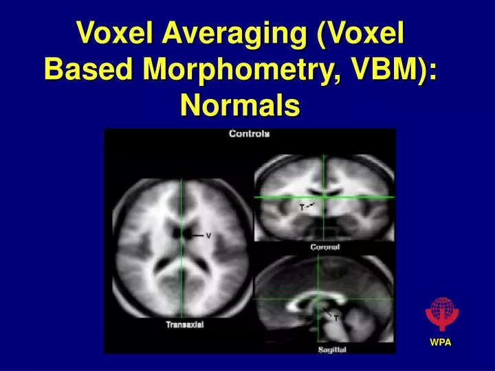 voxel averaging voxel based morphometry vbm normals