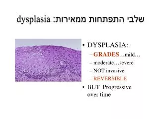 dysplasia