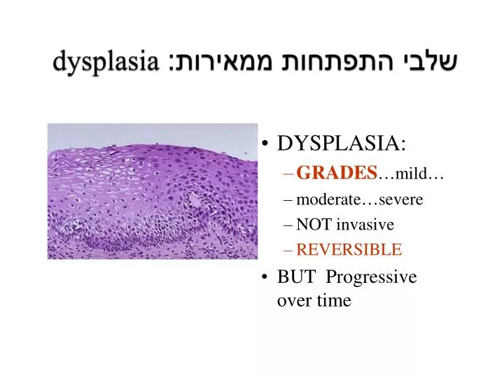 dysplasia