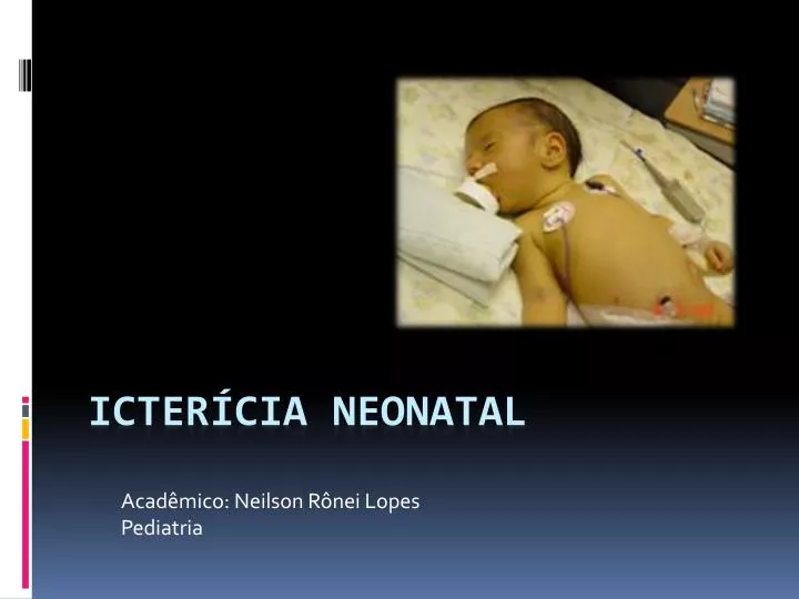 acad mico neilson r nei lopes pediatria