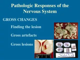 Pathologic Responses of the Nervous System