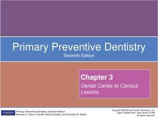 Chapter 3 Dental Caries to Carious Lesions
