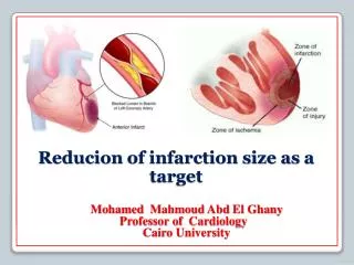 Reducion of infarction size as a target