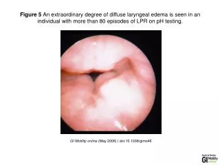 GI Motility online (May 2006) | doi:10.1038/gimo46