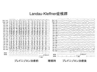 landau kleffner