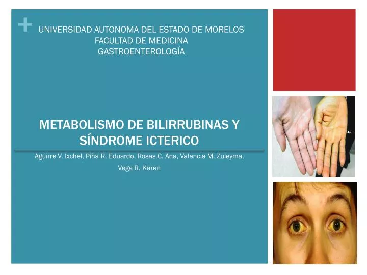 metabolismo de bilirrubinas y s ndrome icterico