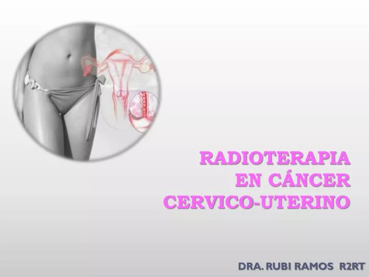 radioterapia en c ncer cervico uterino