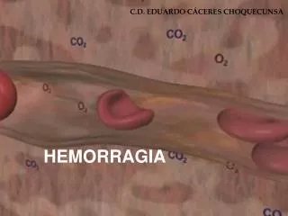 hemorragia