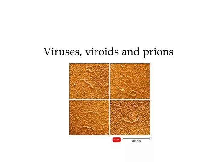 viruses viroids and prions