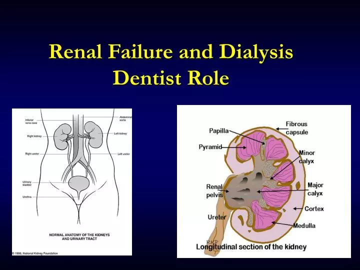 renal failure and dialysis dentist role