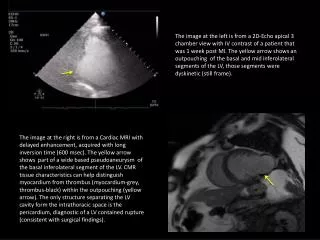 ACCPR_case1